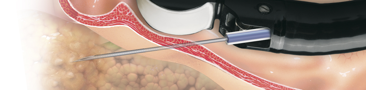 sonotip-pro-control-anatomie2.jpg